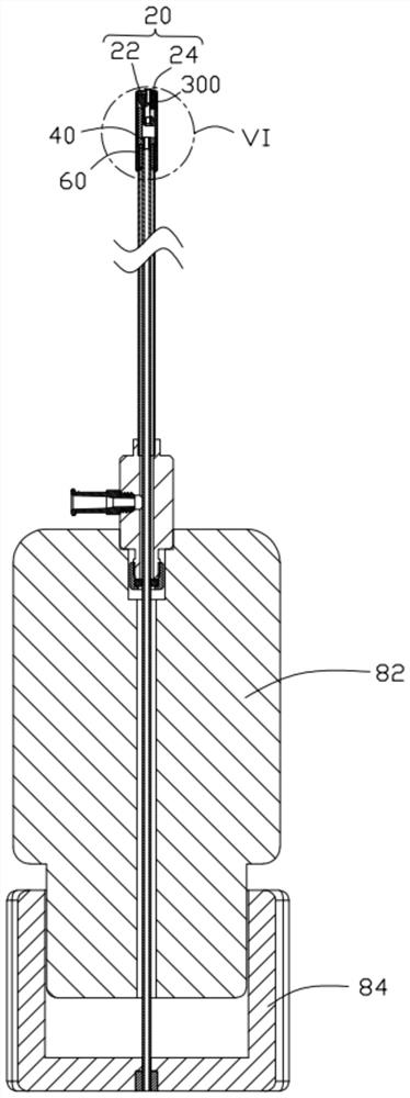 A locking nail for locking sutures and an interventional remote suture locking device