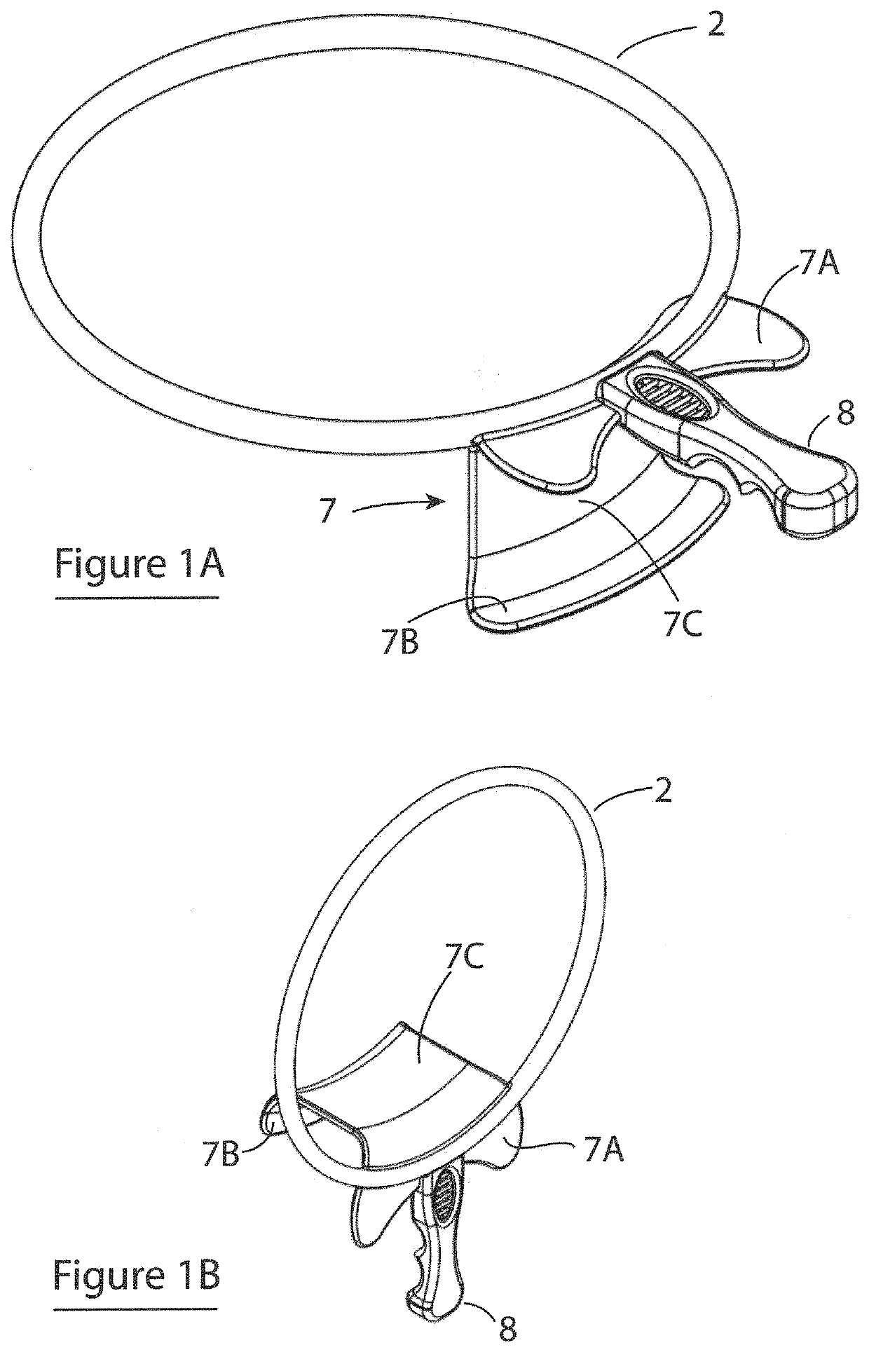 Method of facilitating access to a neonoate through a caesarean incision in the woman's abdomen by opening the incision