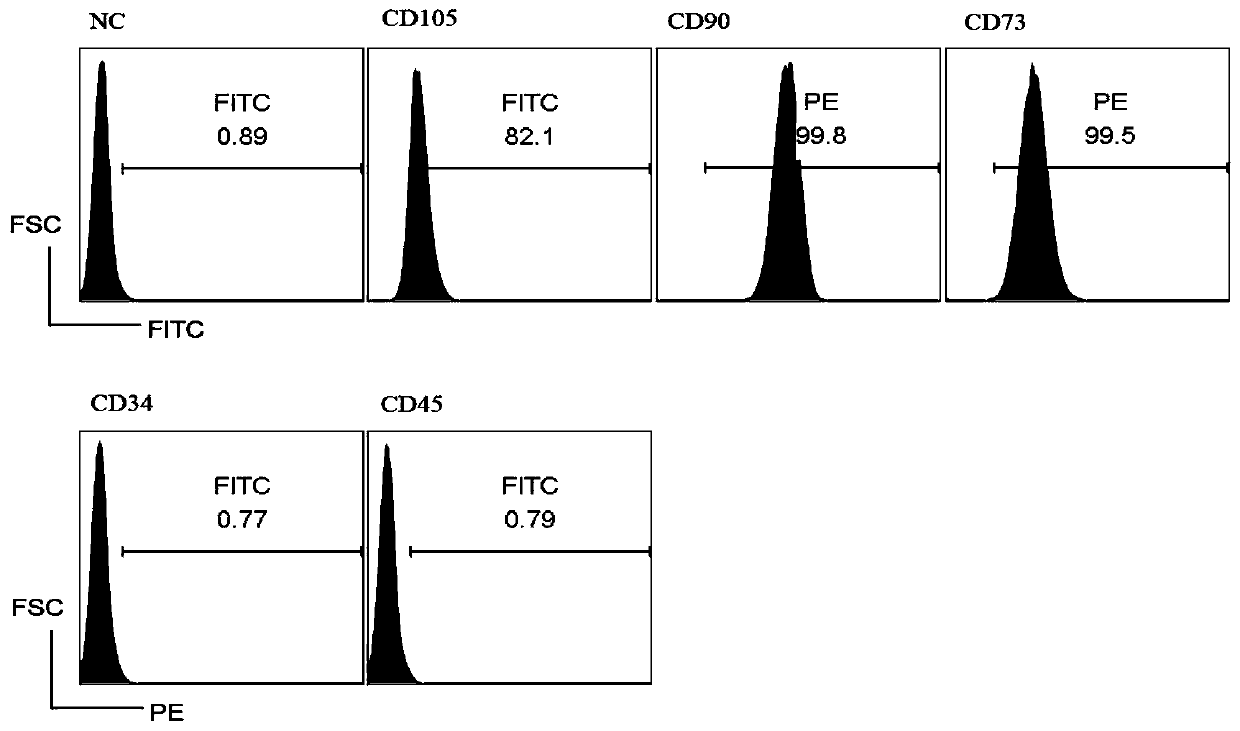 Preparation method and storage method for placenta-derived mesenchymal stem cell exosome