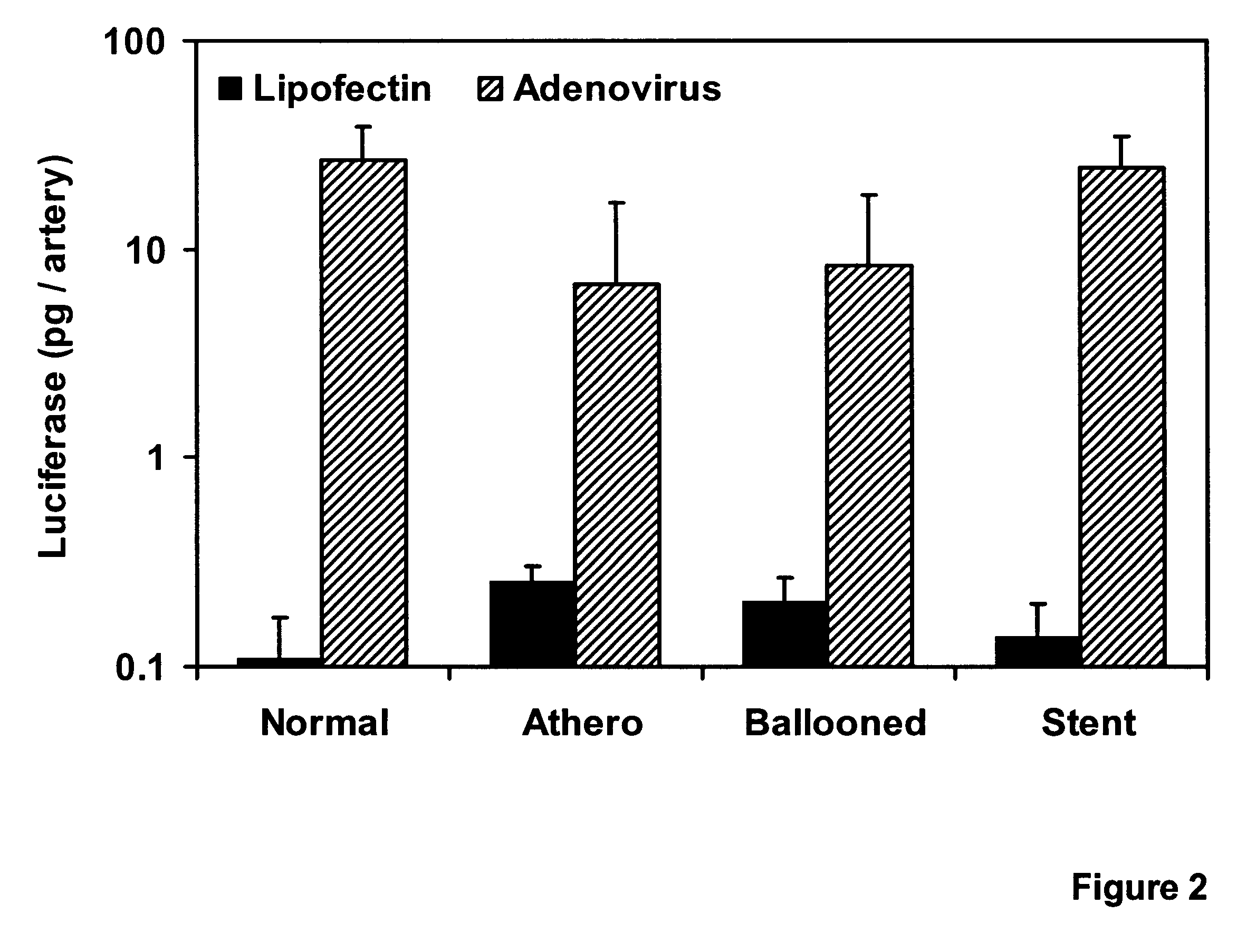 Adenoviral vector for inhibiting restenosis