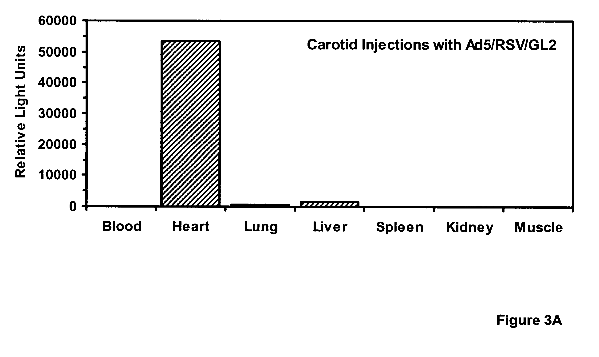 Adenoviral vector for inhibiting restenosis