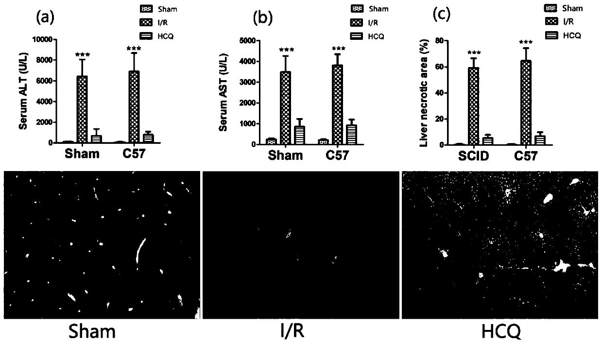 New application of hydroxychloroquine