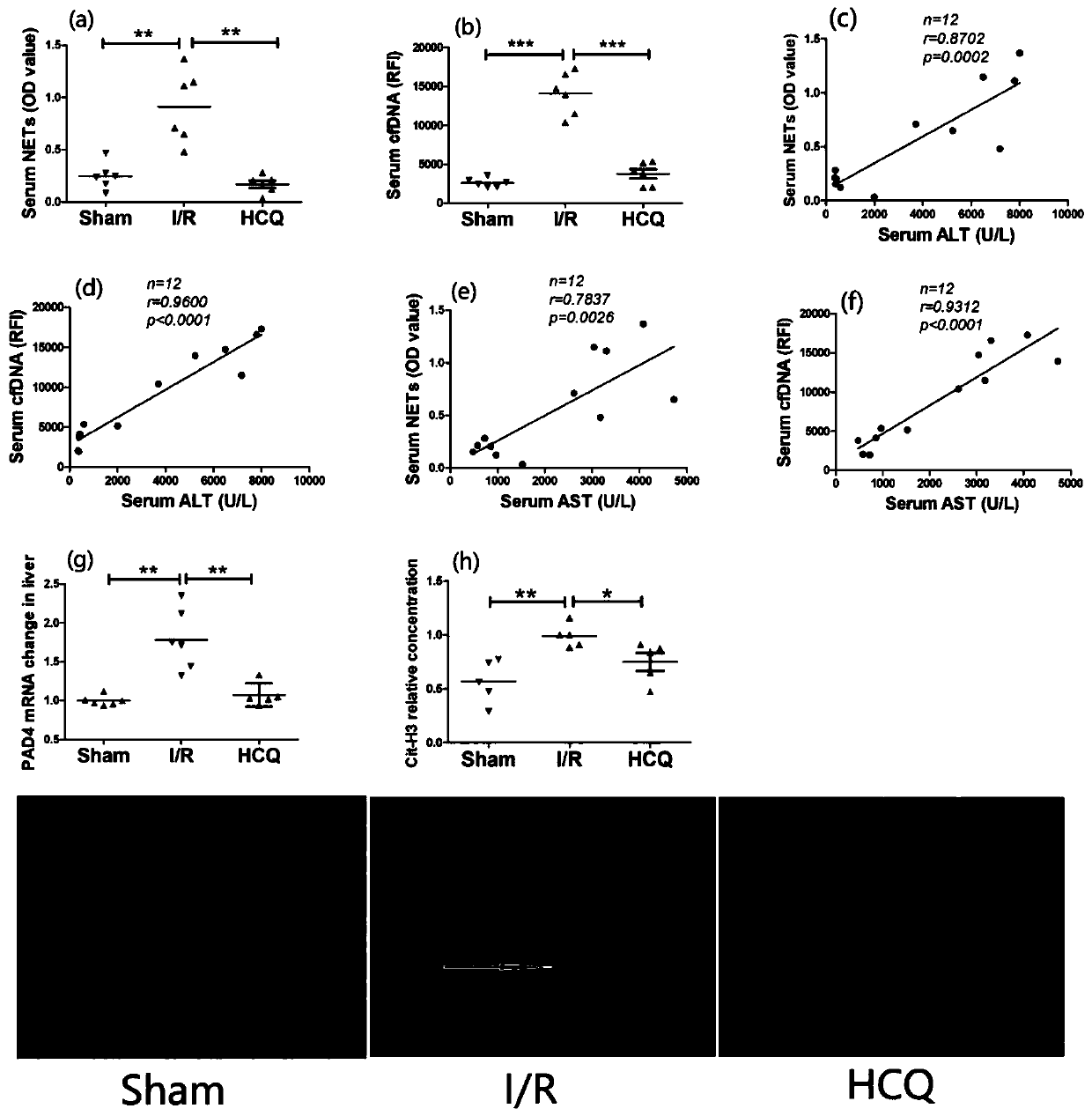 New application of hydroxychloroquine