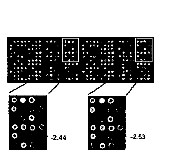 Method for detecting gastric cancer by detecting VLDLR gene