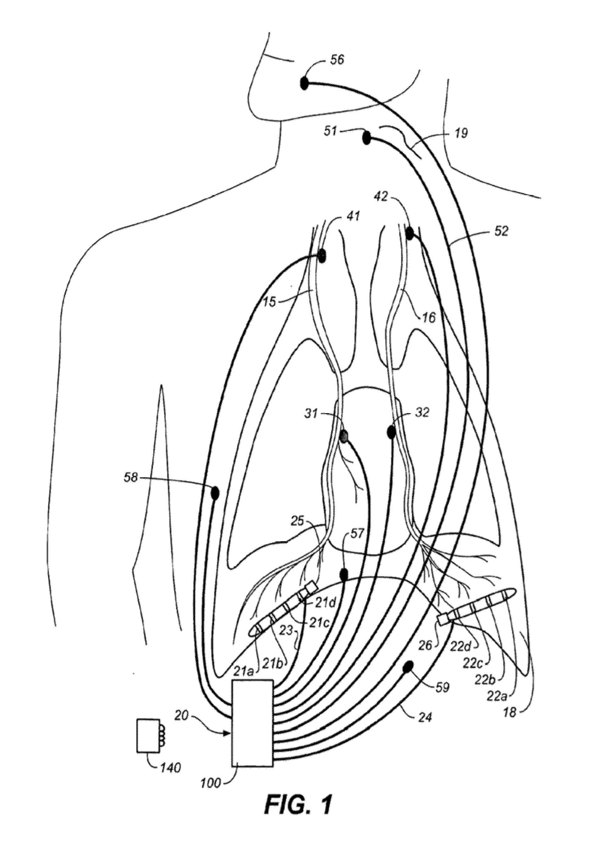 Therapeutic diaphragm stimulation device and method