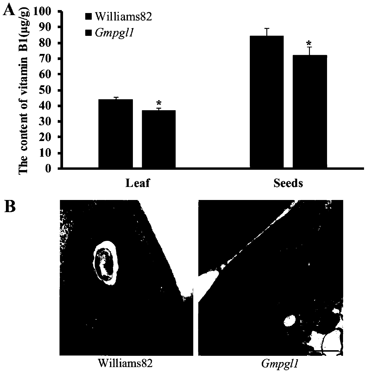 Gene for controlling content of soybean vitamin B1 and application of gene