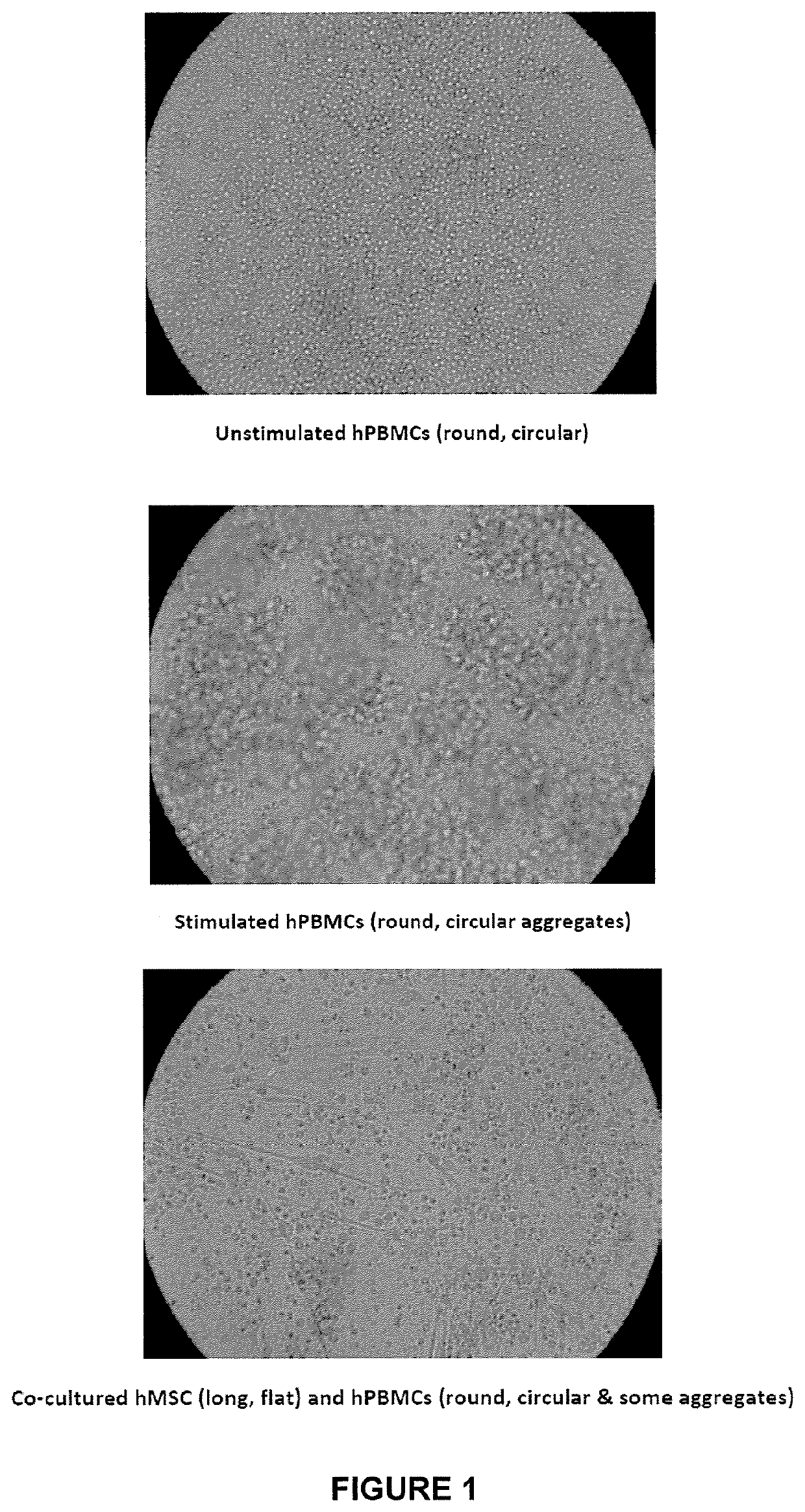 Mesenchymal lineage precursor or stem cells with enhanced immunosuppression