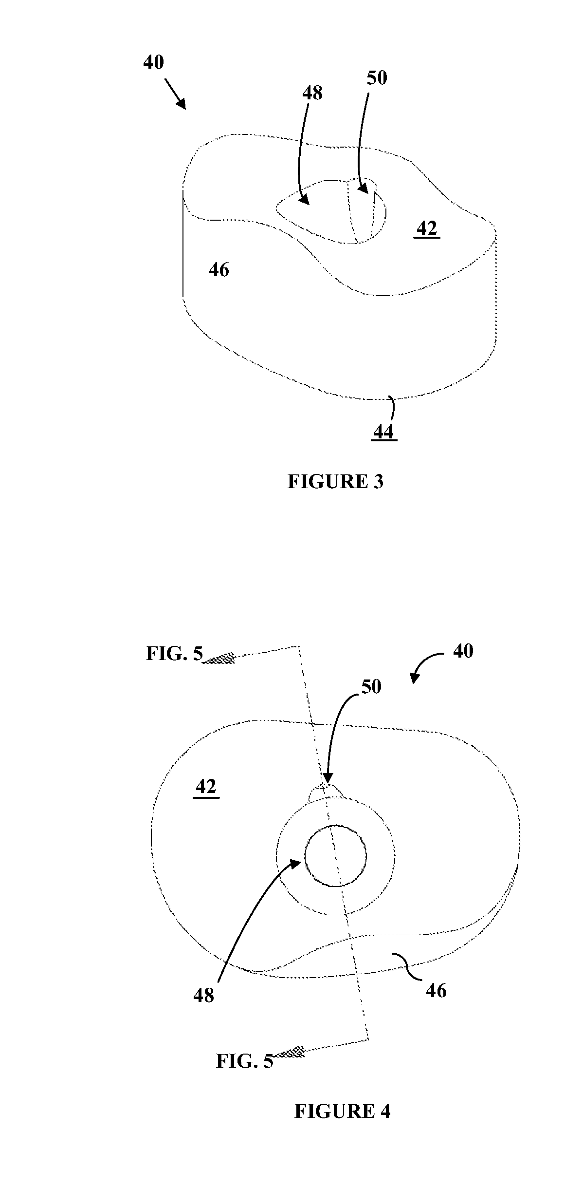 Orthopaedic implant system and fasteners for use therein