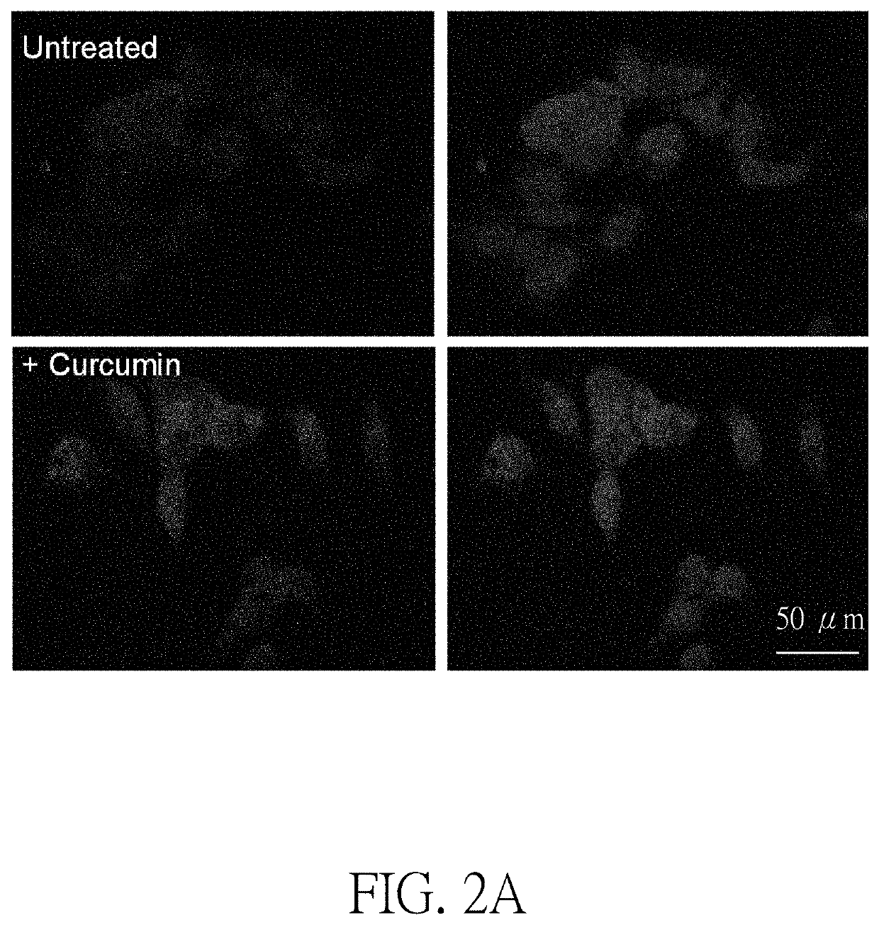 Method for treating abnormal B-amyloid aggregation mediated diseases