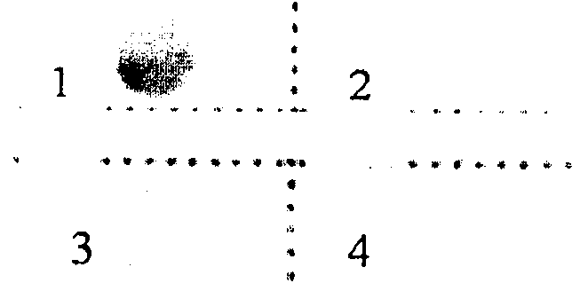 Human papilomavirus typing gene chip detecting system