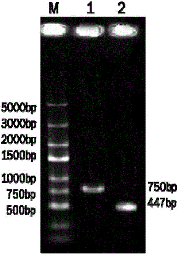 Recombinant adenovirus capable of co-expressing double antibacterial genes of SAL-2 and hLYZ, and construction method and application thereof