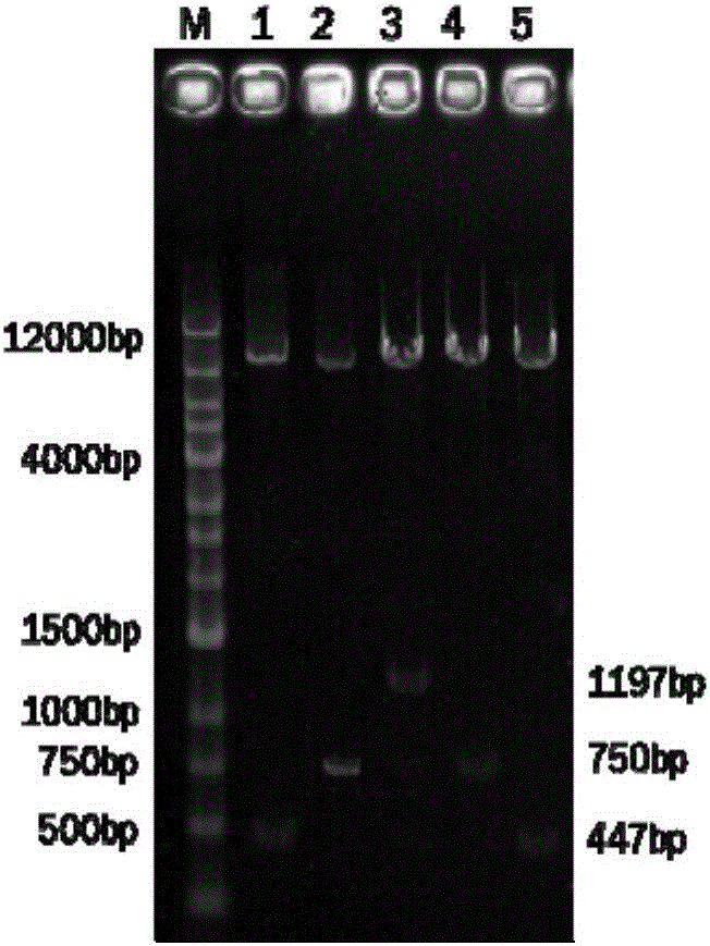 Recombinant adenovirus capable of co-expressing double antibacterial genes of SAL-2 and hLYZ, and construction method and application thereof