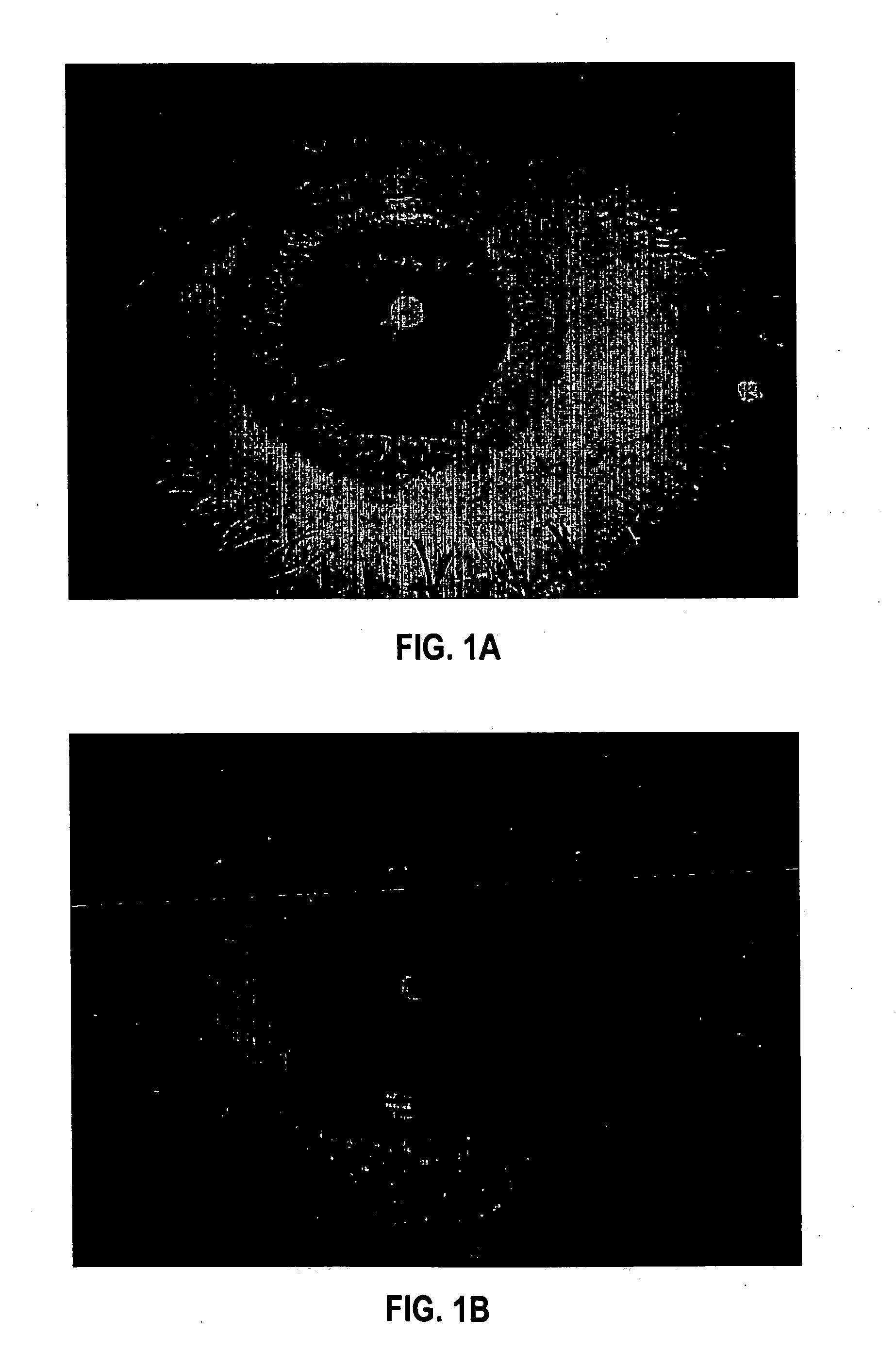 Formulation and method for administration of ophthalmologically active agents