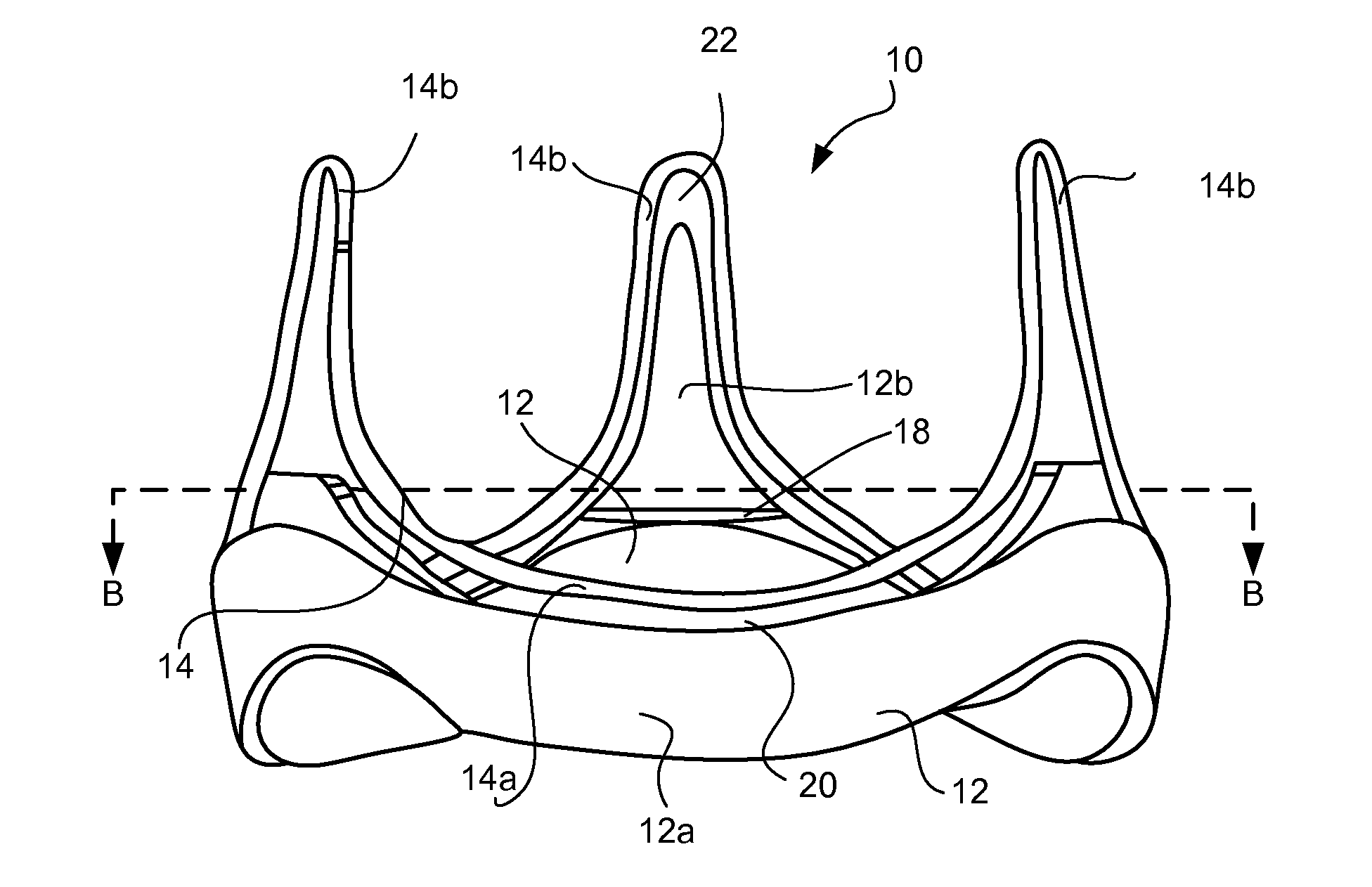 Prosthetic Heart Valve