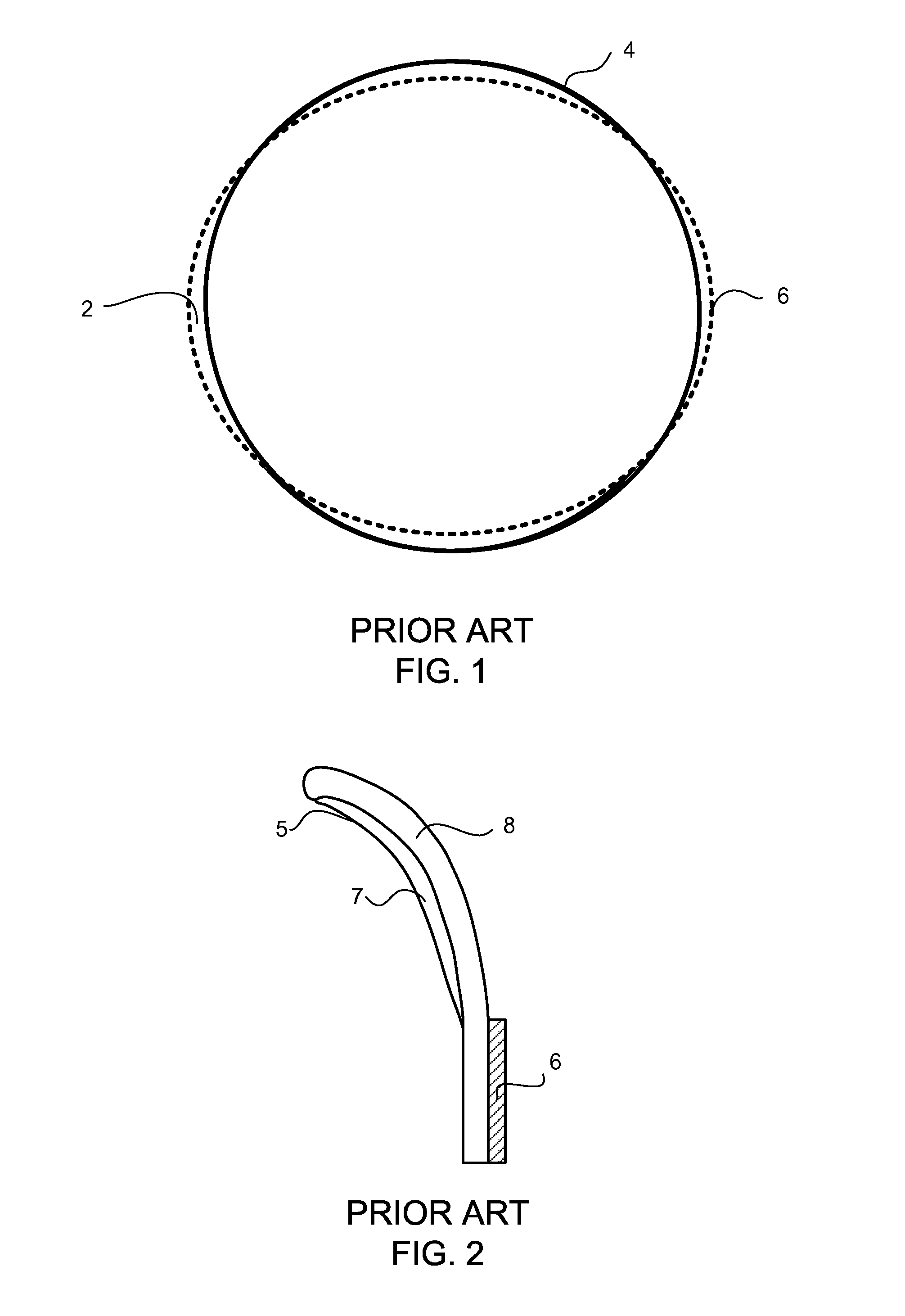 Prosthetic Heart Valve