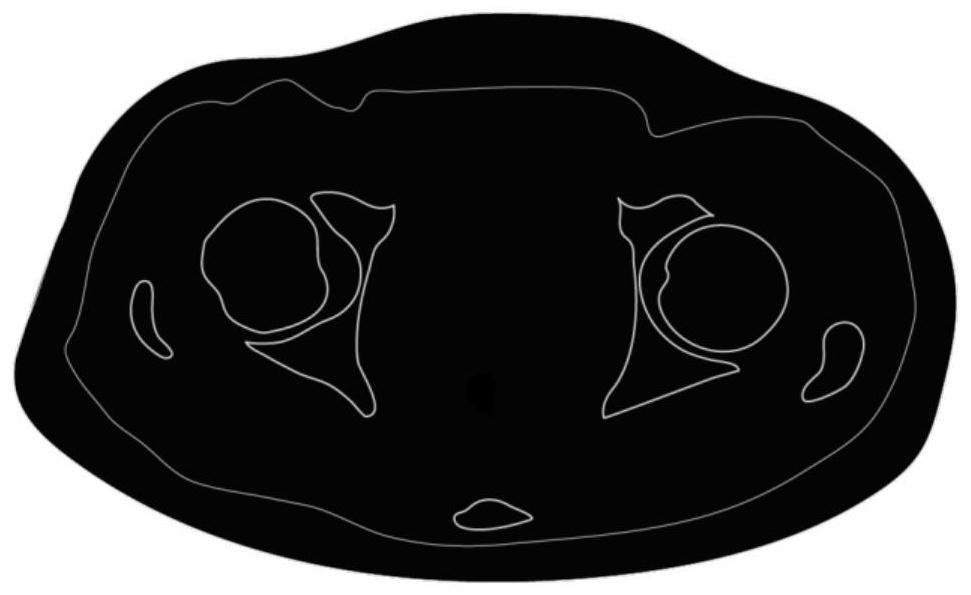 Multi-modal medical image fusion method and system based on deep learning