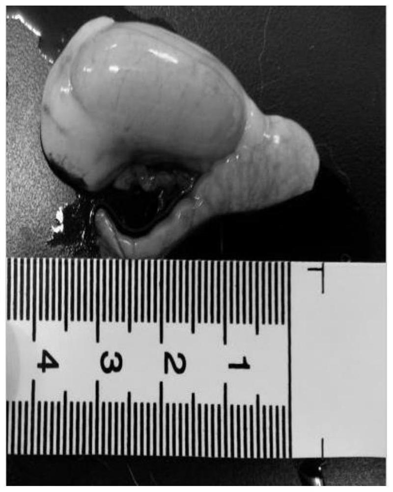 A kind of medicine for treating chronic orchid epididymitis and its preparation method