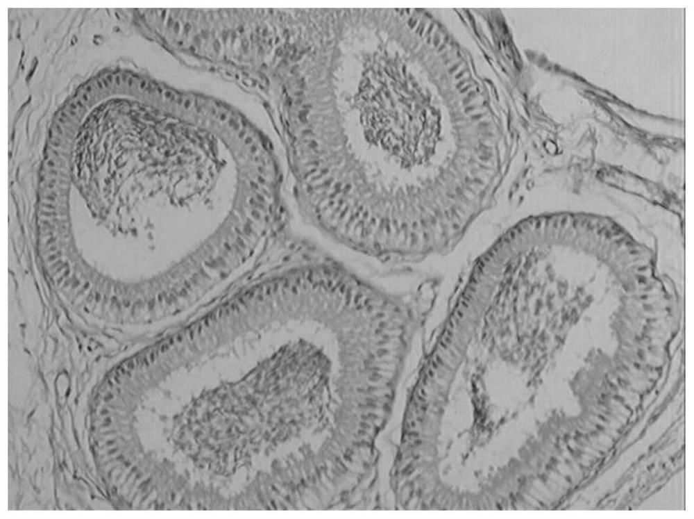 A kind of medicine for treating chronic orchid epididymitis and its preparation method