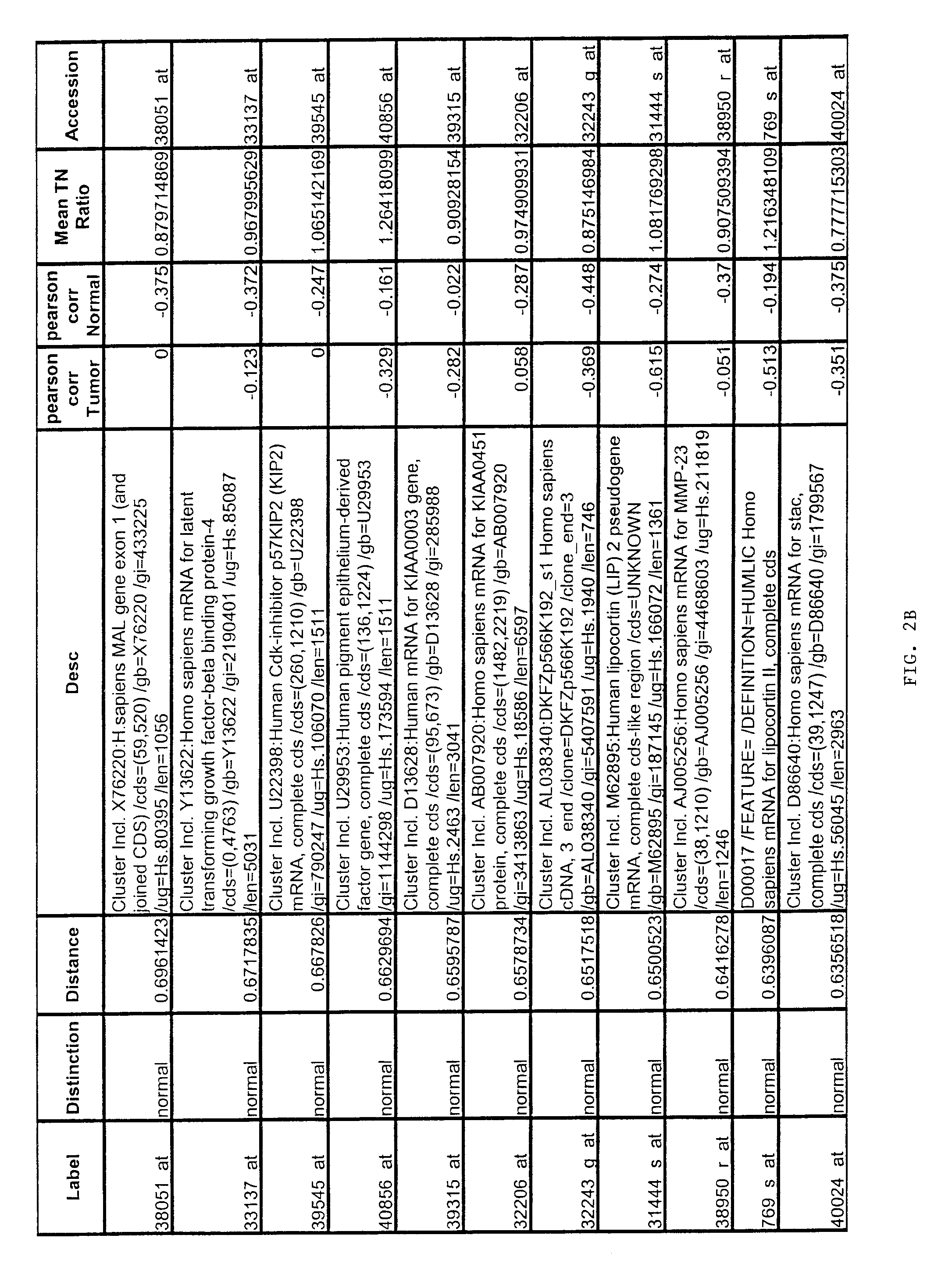 Prostate cancer diagnosis and outcome prediction by expression analysis