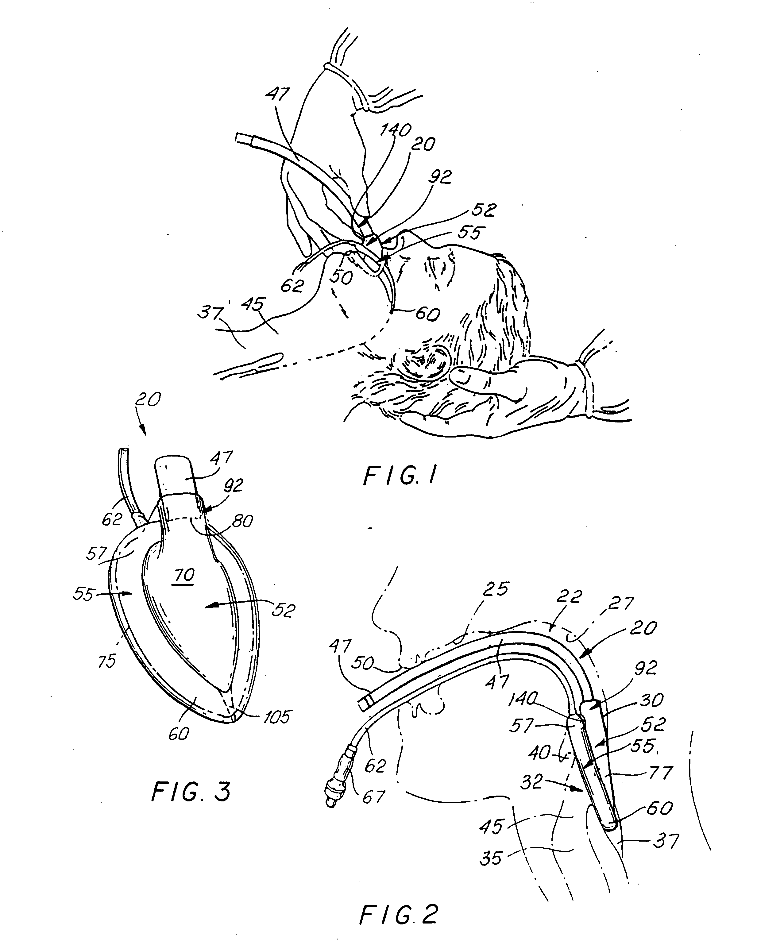 Laryngeal mask airway device