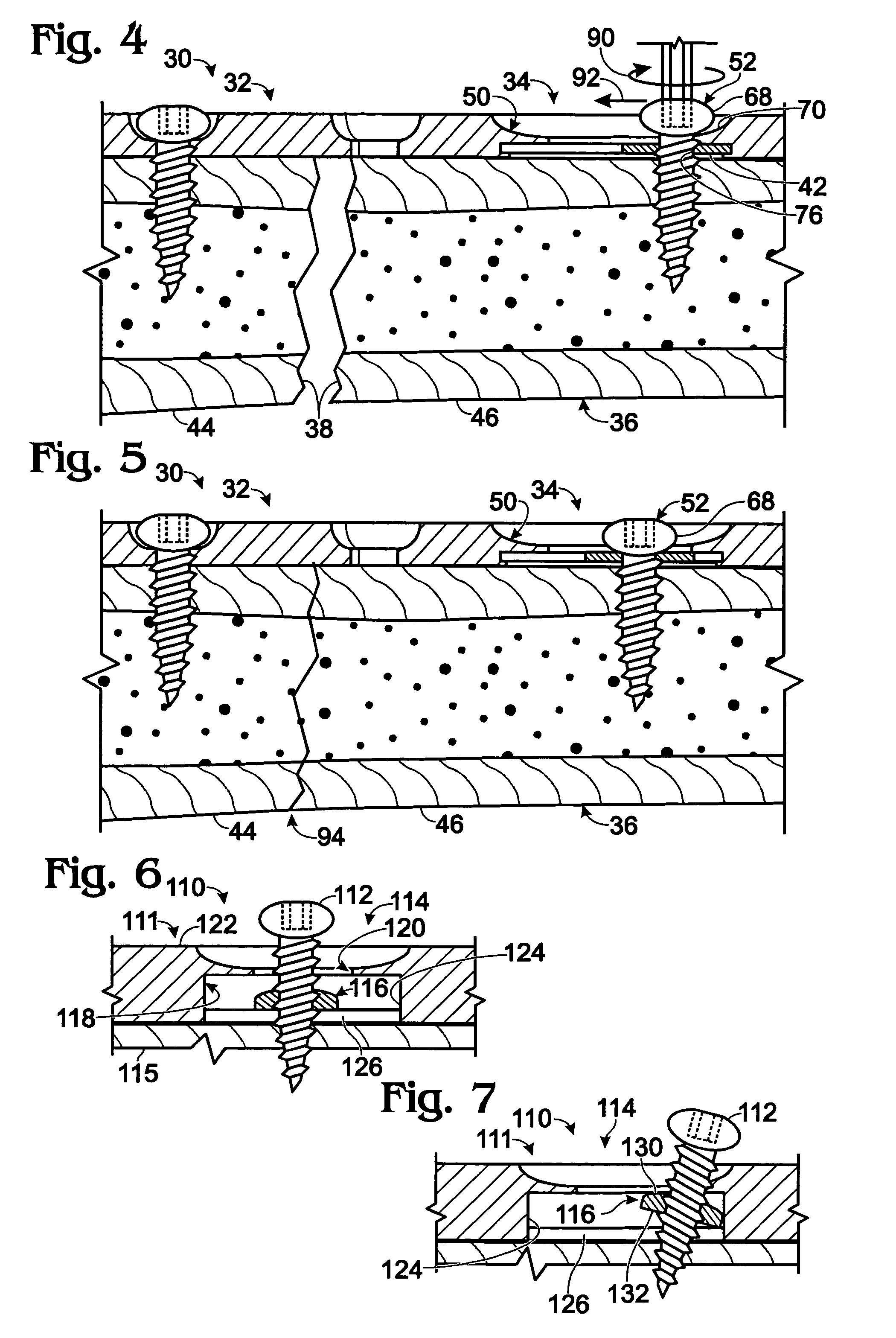 Bone plates with movable locking elements