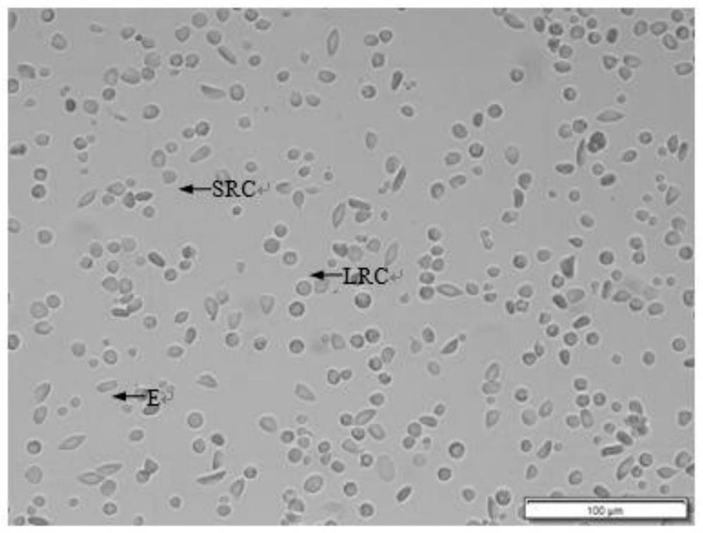 A kind of preparation method of fish single cell suspension