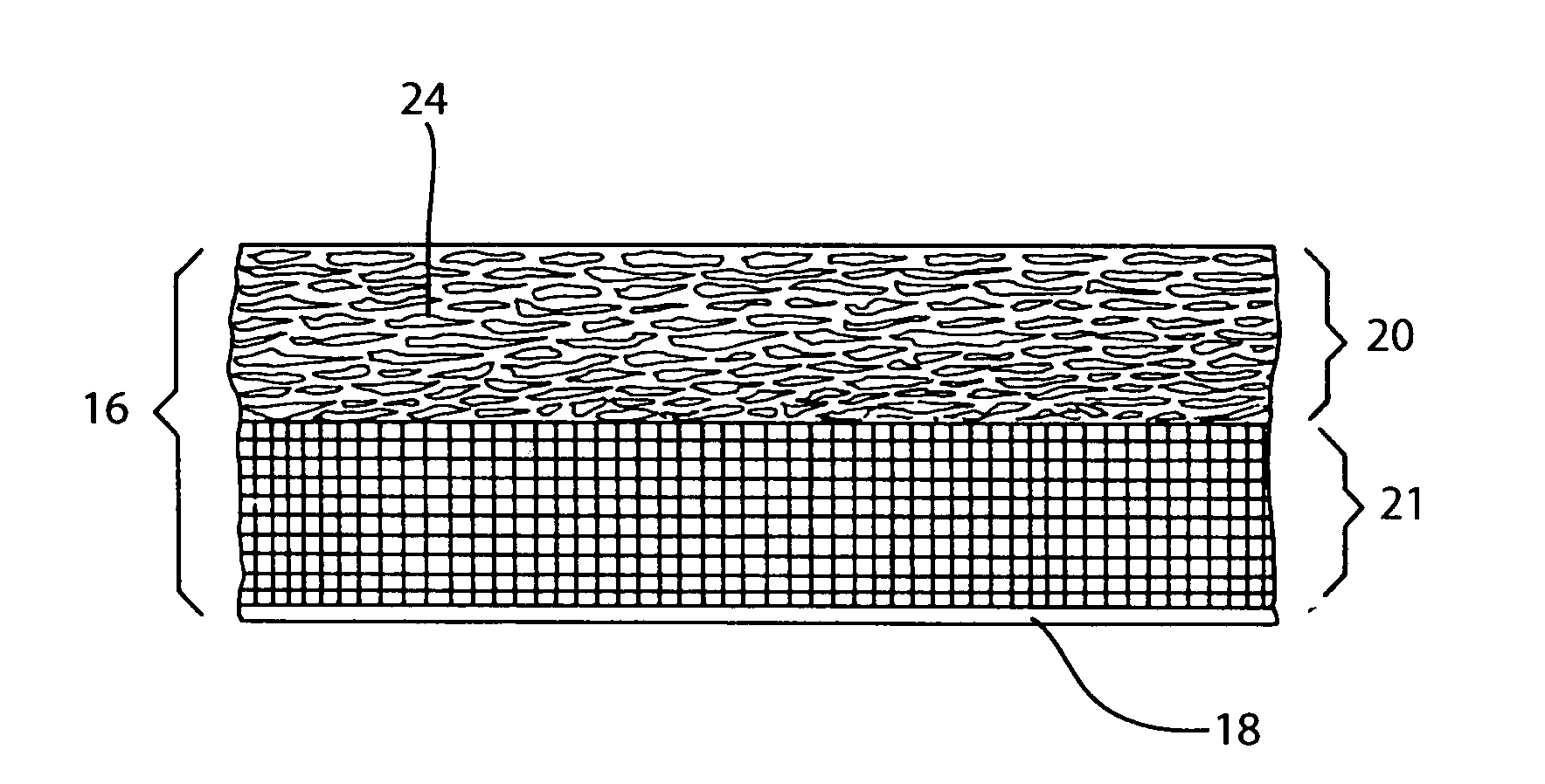 Atomic layer epitaxy processed insulation