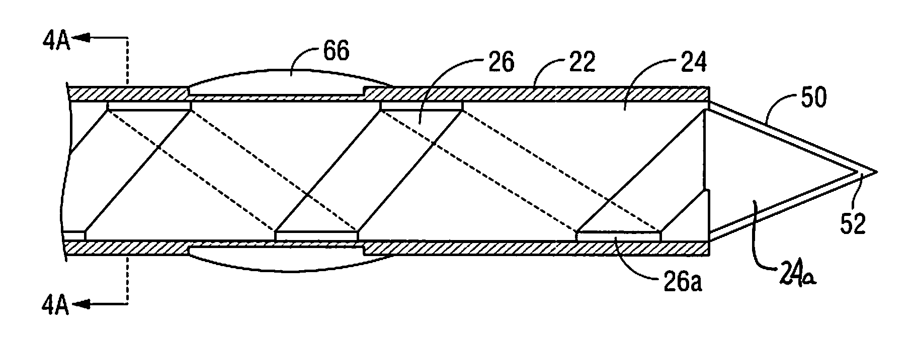 Endovascular tissue removal device