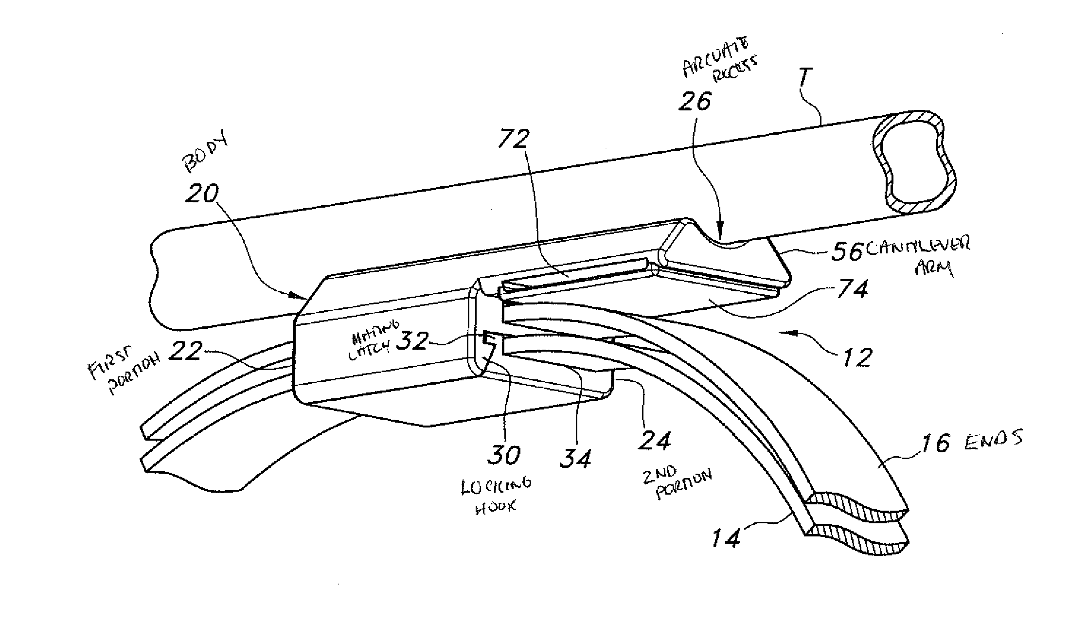 Bridle system for placing and securing a nasal tube in a patient