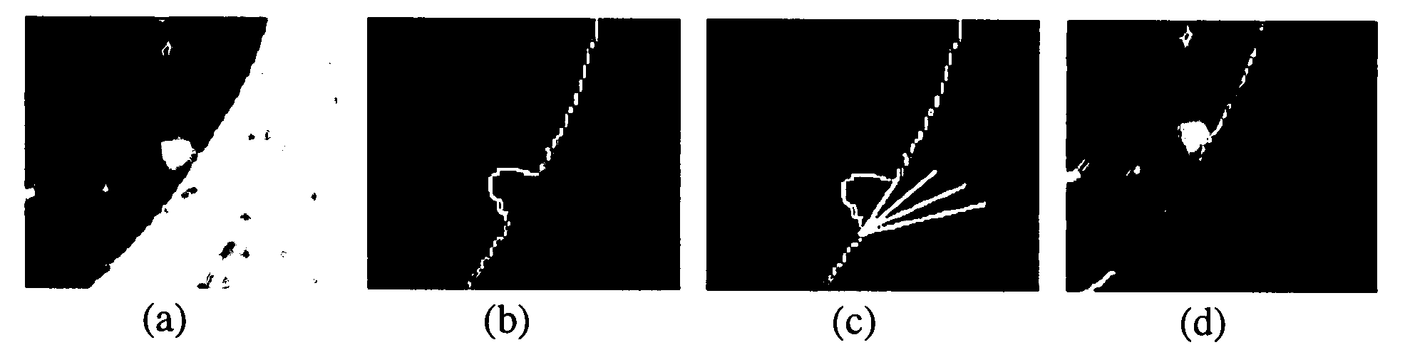 Registration System and Method For Tracking Lung Nodules In Medical Images