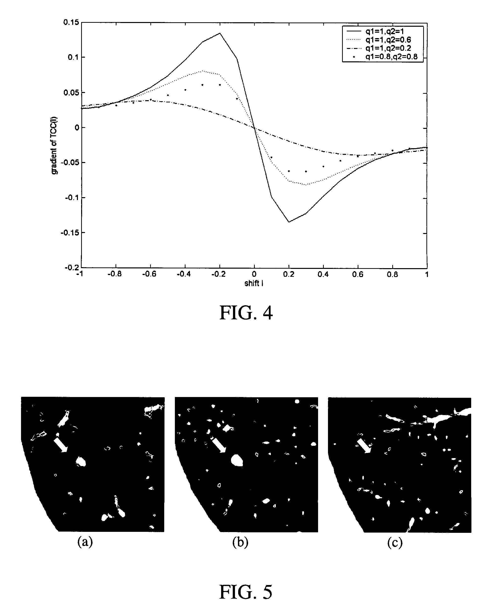 Registration System and Method For Tracking Lung Nodules In Medical Images