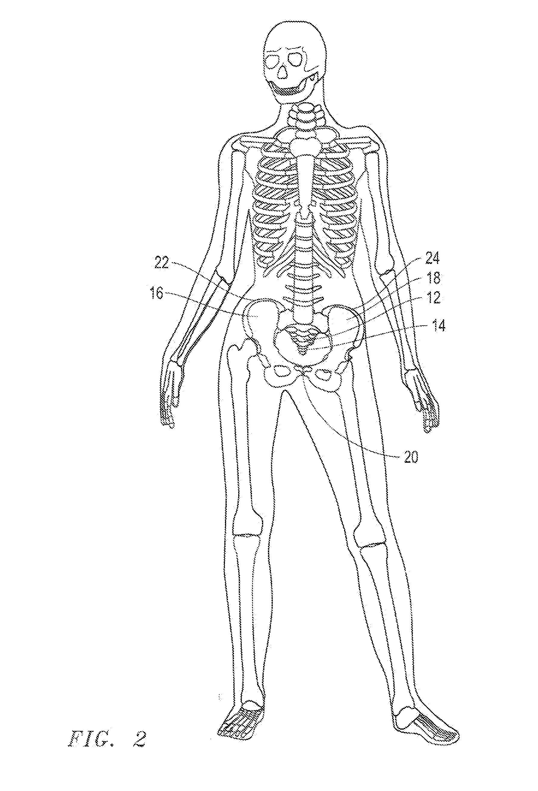 Adjustable pelvic compression belt and methods for reducing the width of, and/or realigning, a user's hips