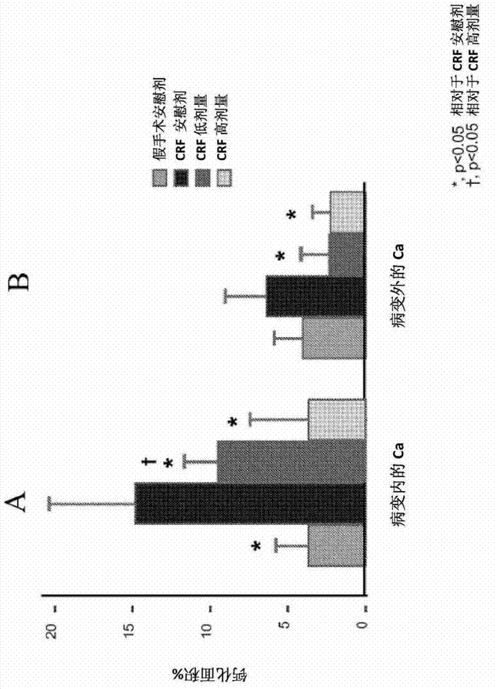 Methods and compositions for reducing or preventing vascular calcification during peritoneal dialysis therapy