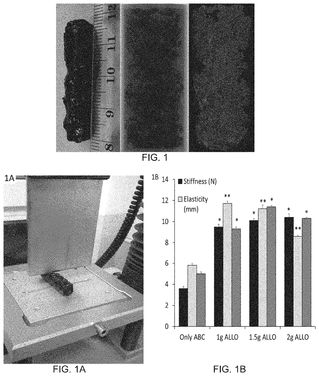 Autologous Bone Graft Substitute