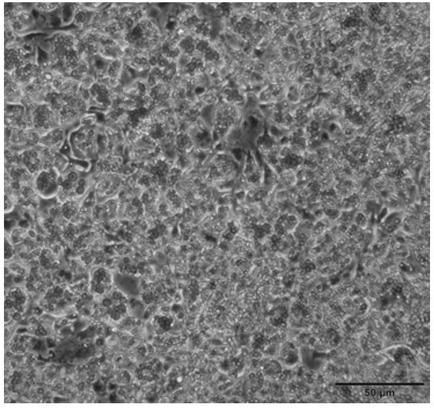 3D printed adipose tissue