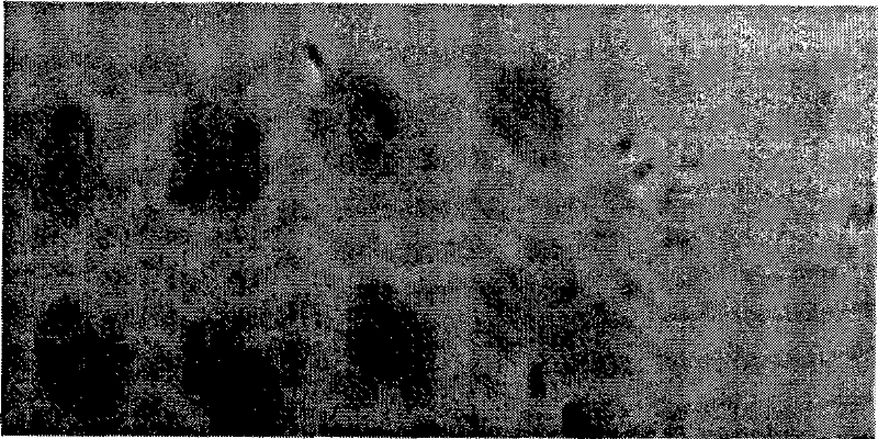 Application of Phage Chip as Protein Chip or Gene Chip