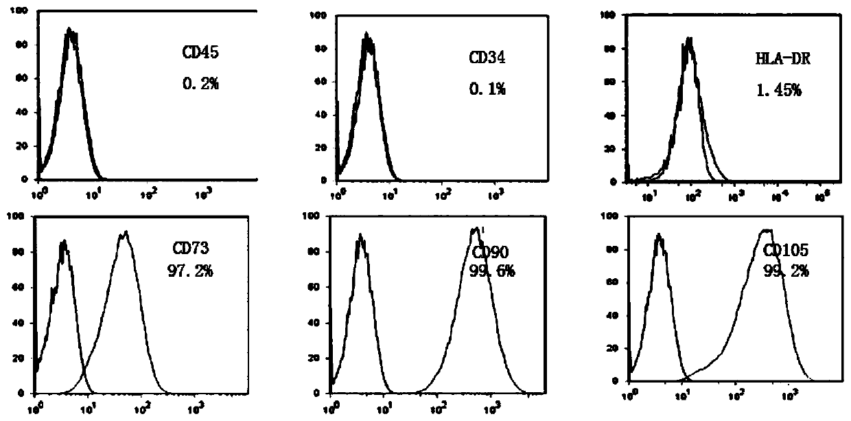 ADSCs conditioned medium capable of preventing rabbit ear acne and production method