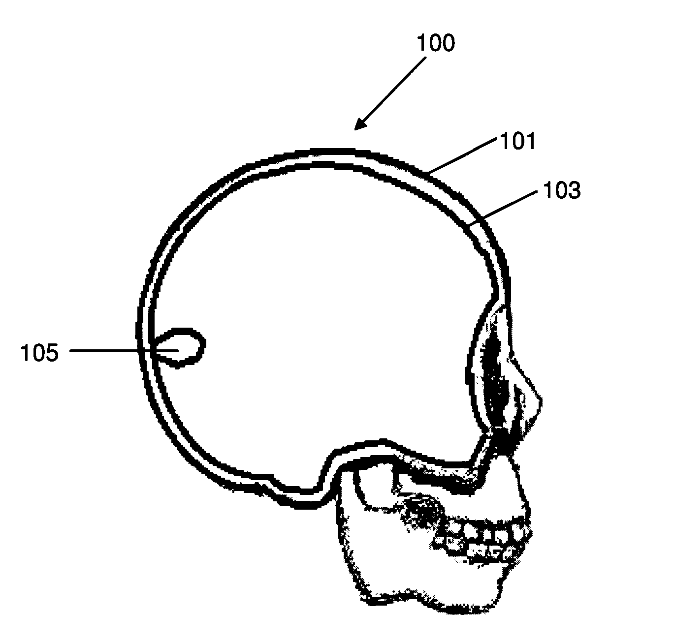 Method for manufacturing a three-dimensional anatomical structure