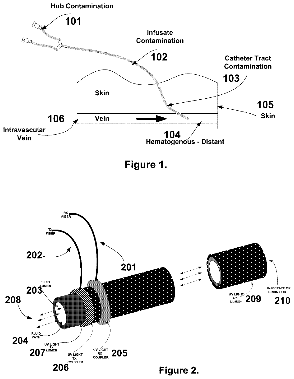 Infection resistant catheter system