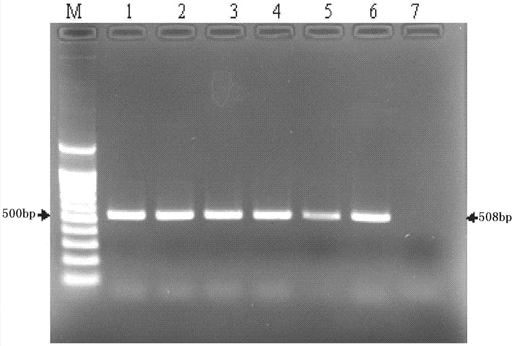 Preparation method and detection of hybridization probe and gene chip for PPV (plum pox virus) major strains