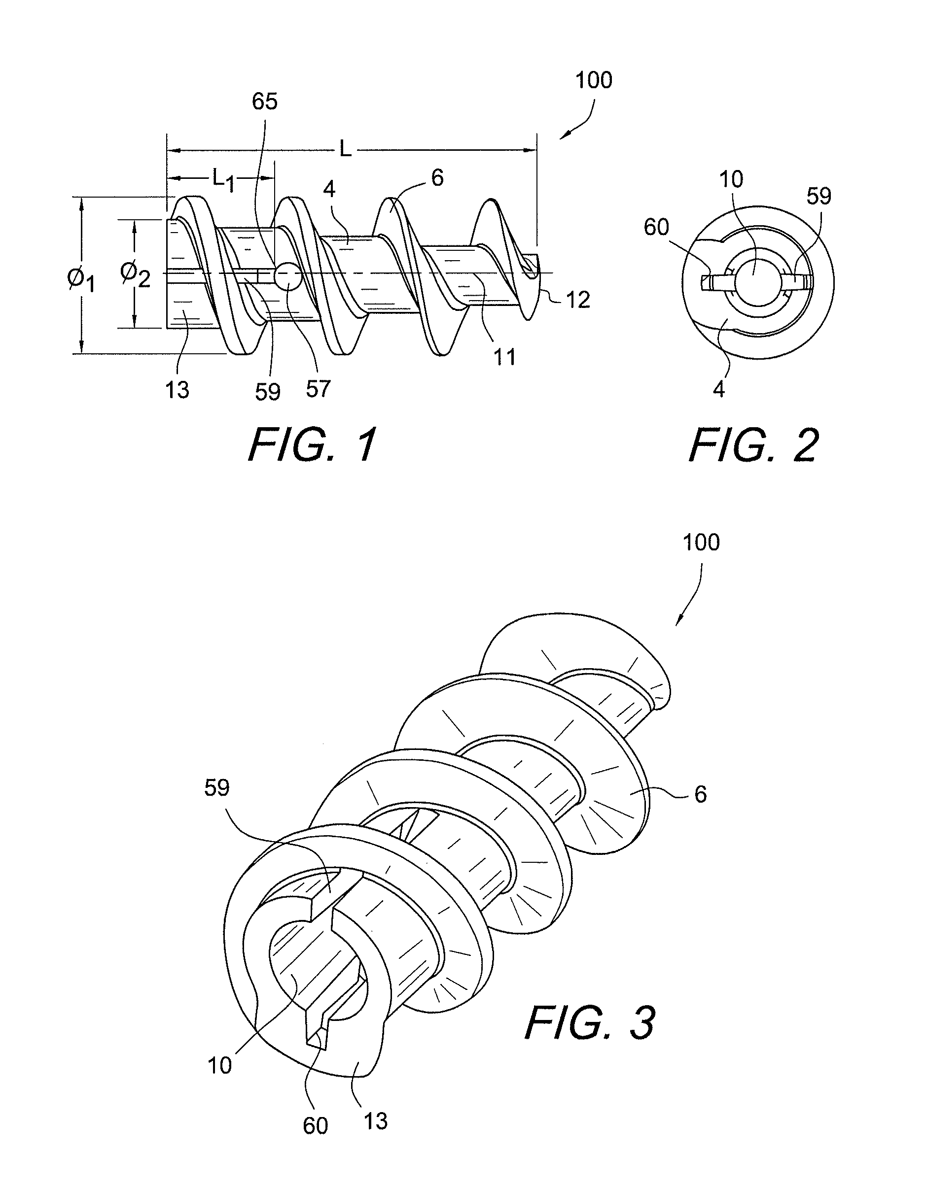 Fully threaded suture anchor with insert-molded suture