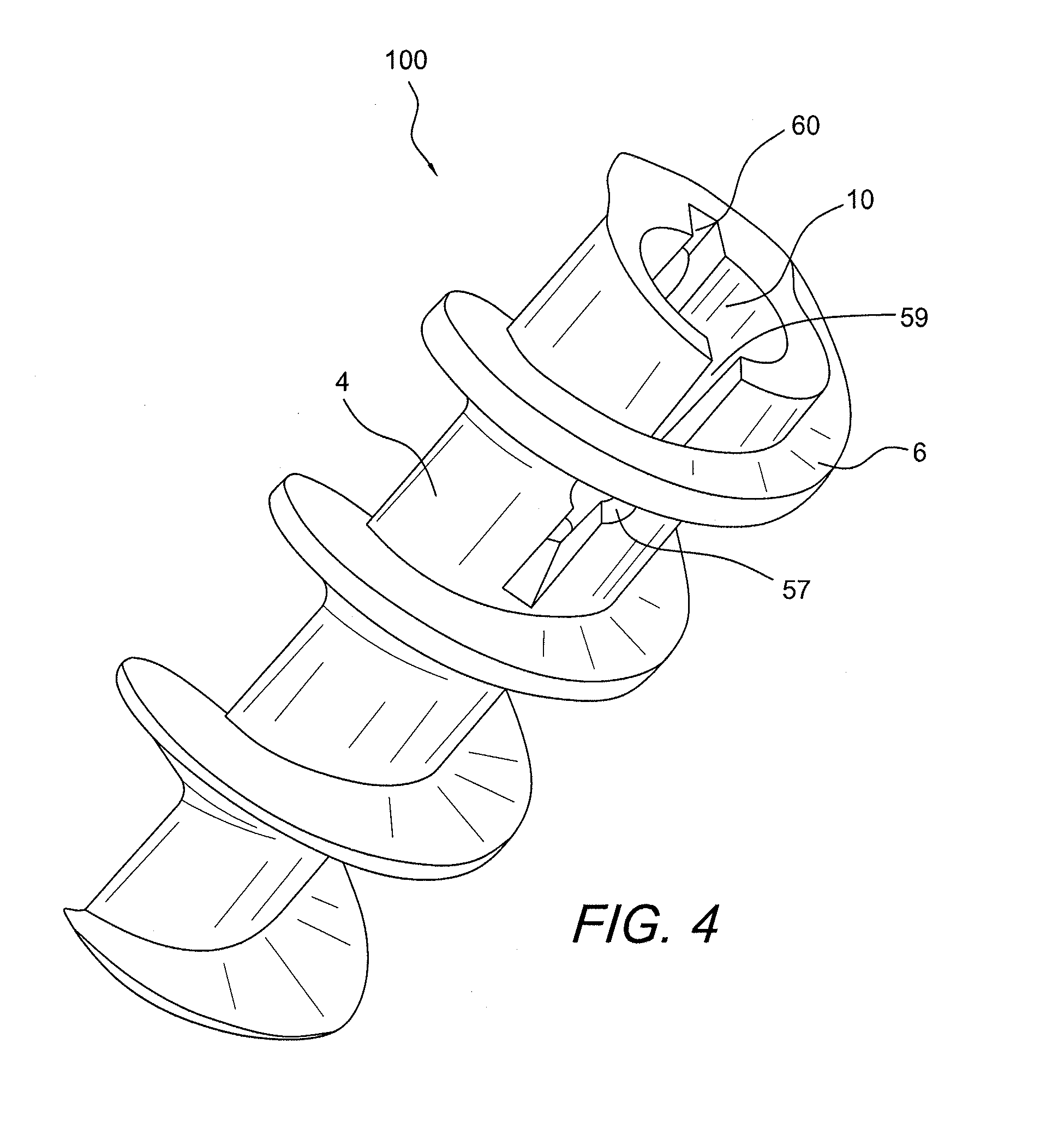 Fully threaded suture anchor with insert-molded suture