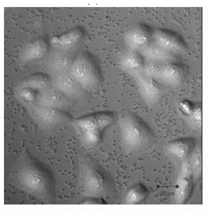 An imaging method of tumor targeting based on enhancement effect of zinc ion signals