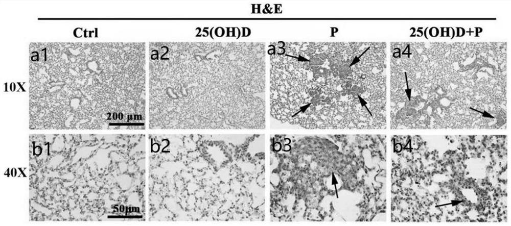 Application of vitamin D in preparation of medicine for regulating macrophages