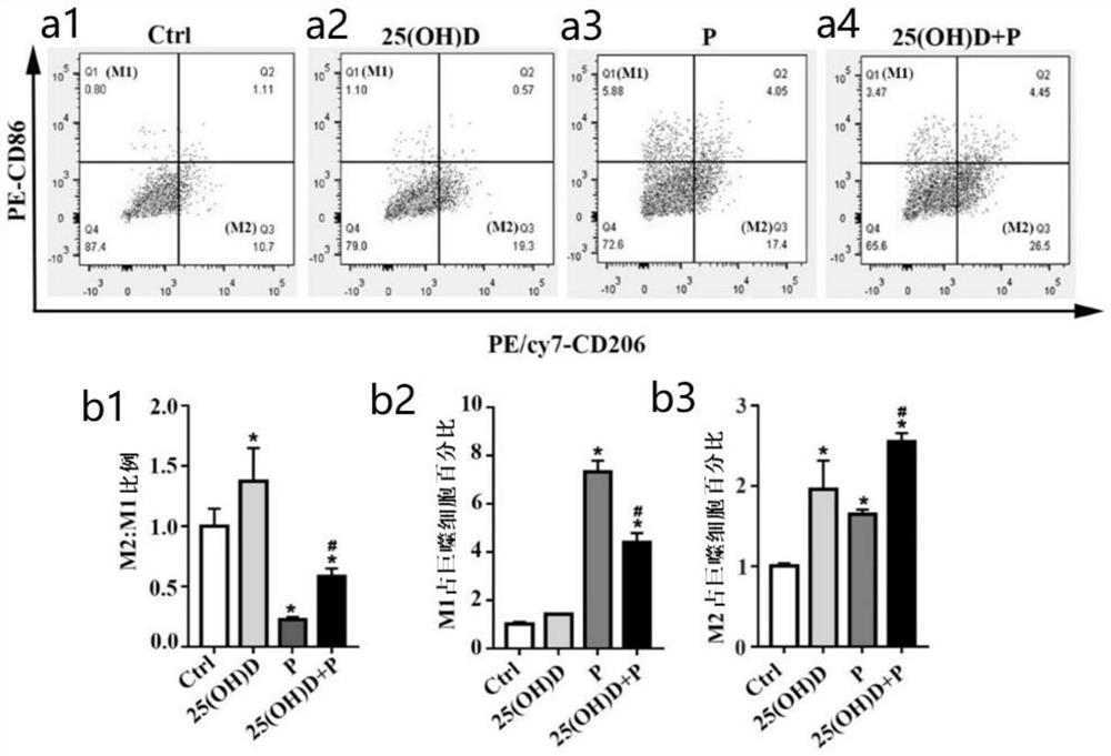 Application of vitamin D in preparation of medicine for regulating macrophages