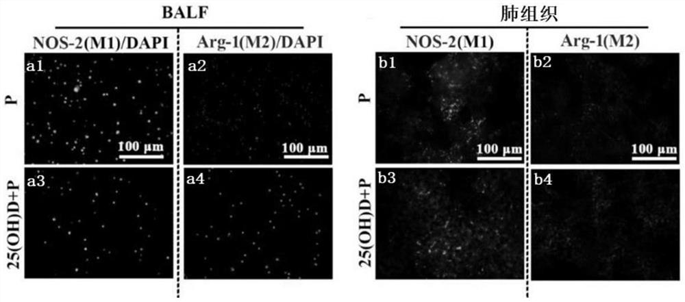 Application of vitamin D in preparation of medicine for regulating macrophages