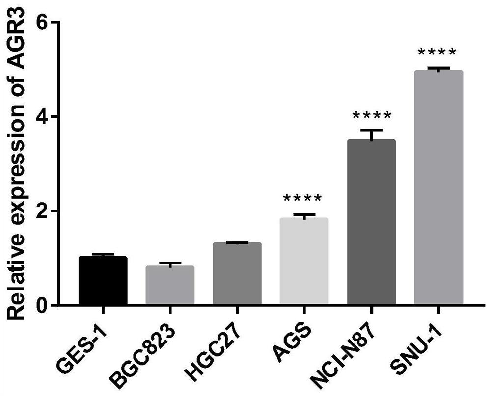 Gastric cancer tumor marker and application thereof