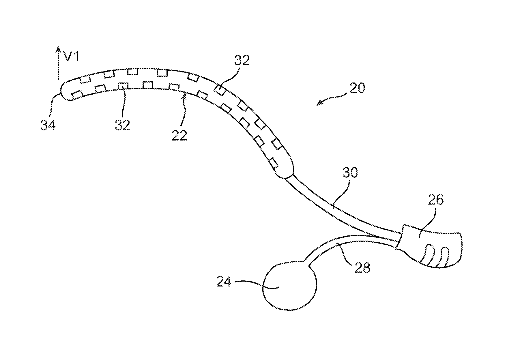 Fluid filled implants for treating medical conditions