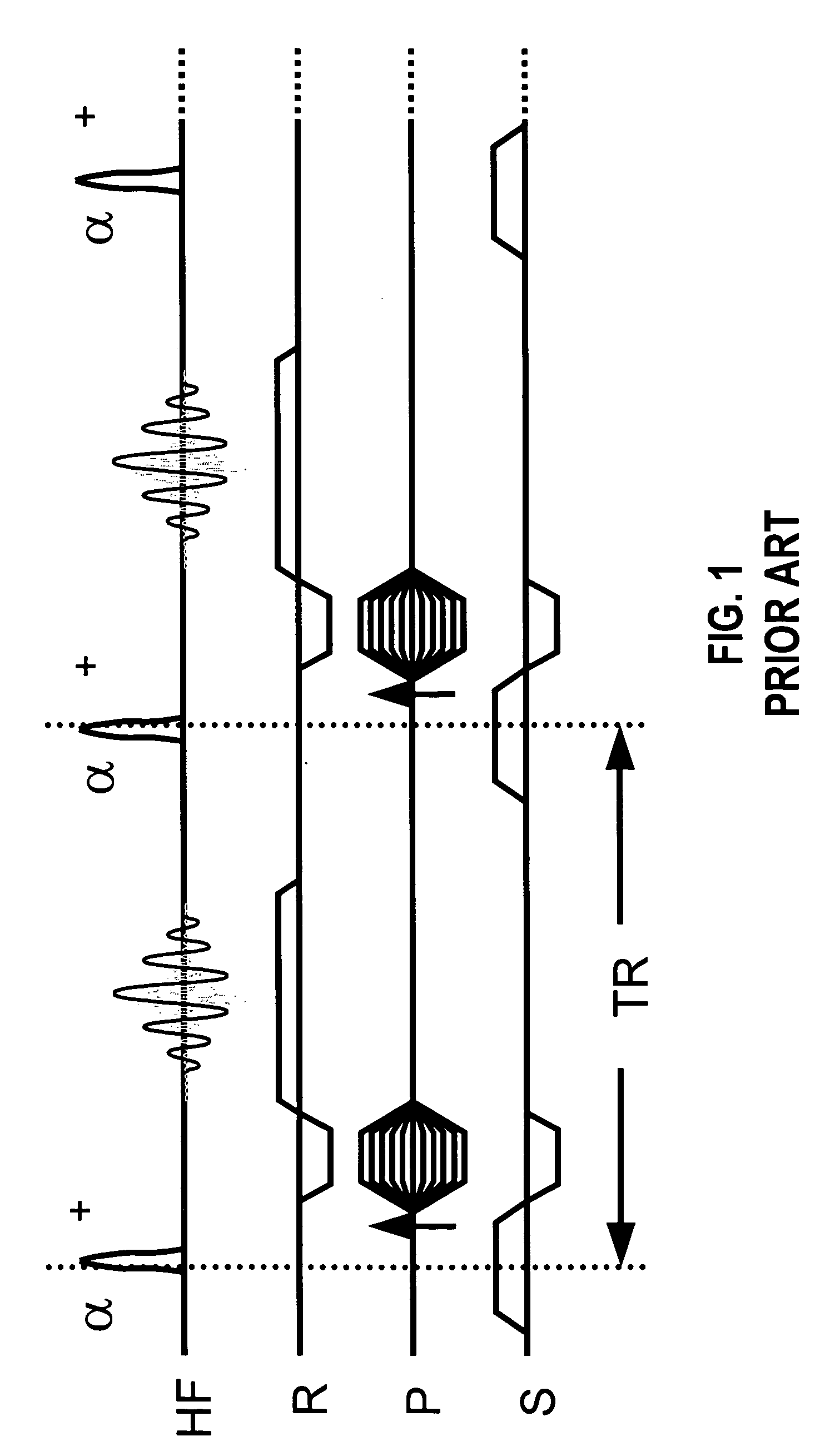 Data acquisition method for accelerated magnetic resonance imaging in framework of the parallel acquisition of MRT data