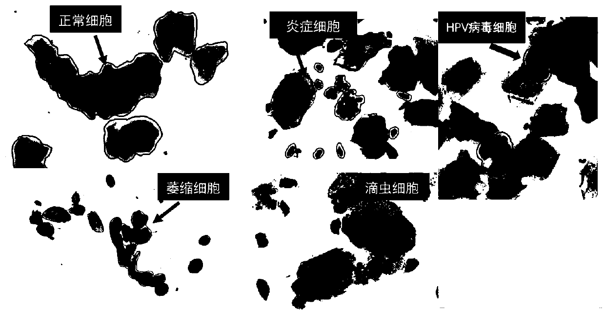 Cell detection segmentation system and method based on a deep learning neural network